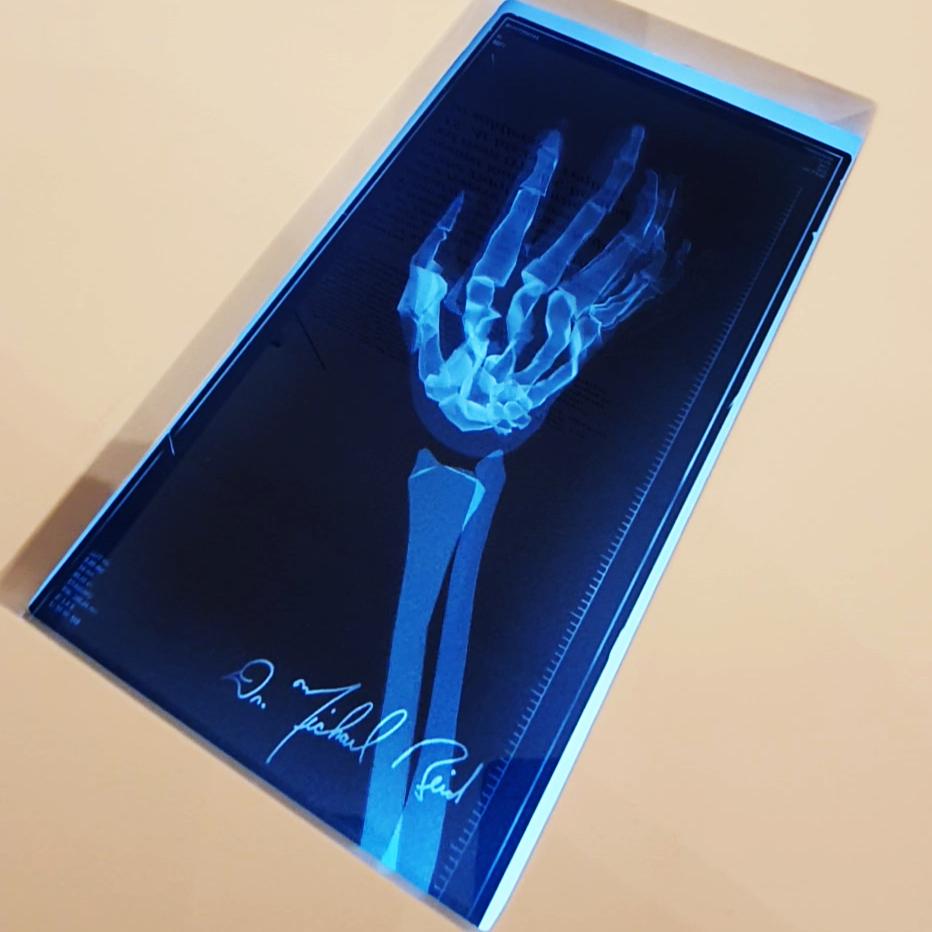 Close-up of a simulated X-ray image displayed within the exhibit at the Museum of the Jewish Community in Sabac, showing a detailed skeletal structure of a hand with a ring, reminiscent of the first X-ray photograph by Dr. Wilhelm Roentgen. The image serves as an educational homage to the early adoption of X-ray technology in Sabac and its medical pioneers.