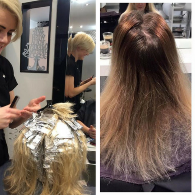 Why We Insist On A Skin Test Blog