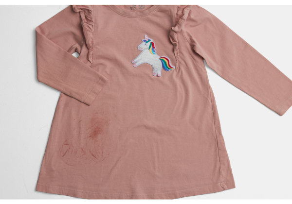 tr&ouml;ja med fettfl&auml;ckar f&ouml;re behandling