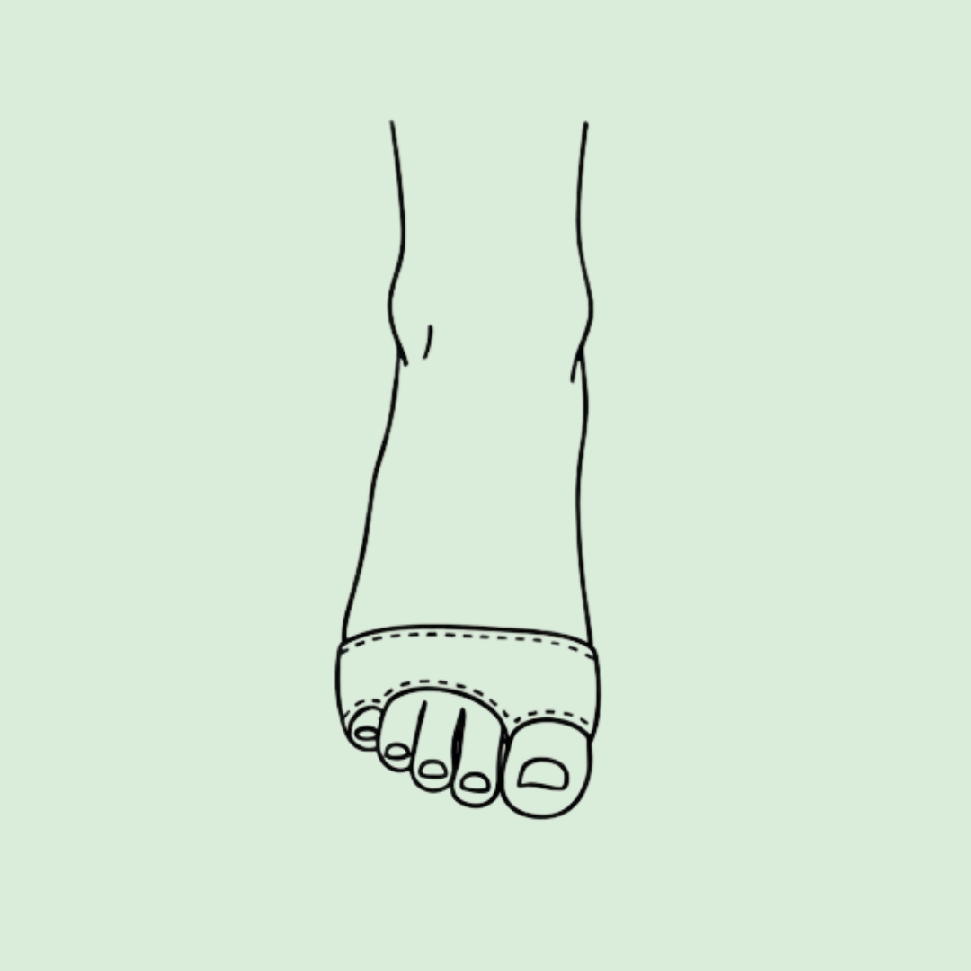 Hallux Valgus
