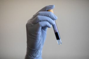 AI-enhanced blood tests could detect Parkinson’s disease seven years before onset
