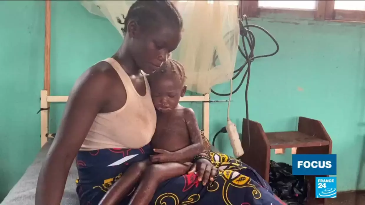 Amid-coronavirus-spread-measles-outbreak-kills-thousands-of-children-in-DR-Congo