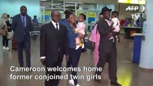 Former-conjoined-twins-return-to-Cameroon