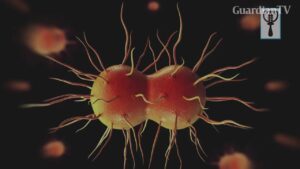Gonorrhea
