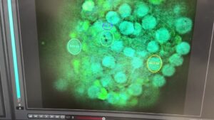 Seaweed-microbots-could-one-day-treat-cancer-researcher-says