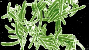 WHO-Tuberculosis-is-the-worlds-deadliest-infectious-disease