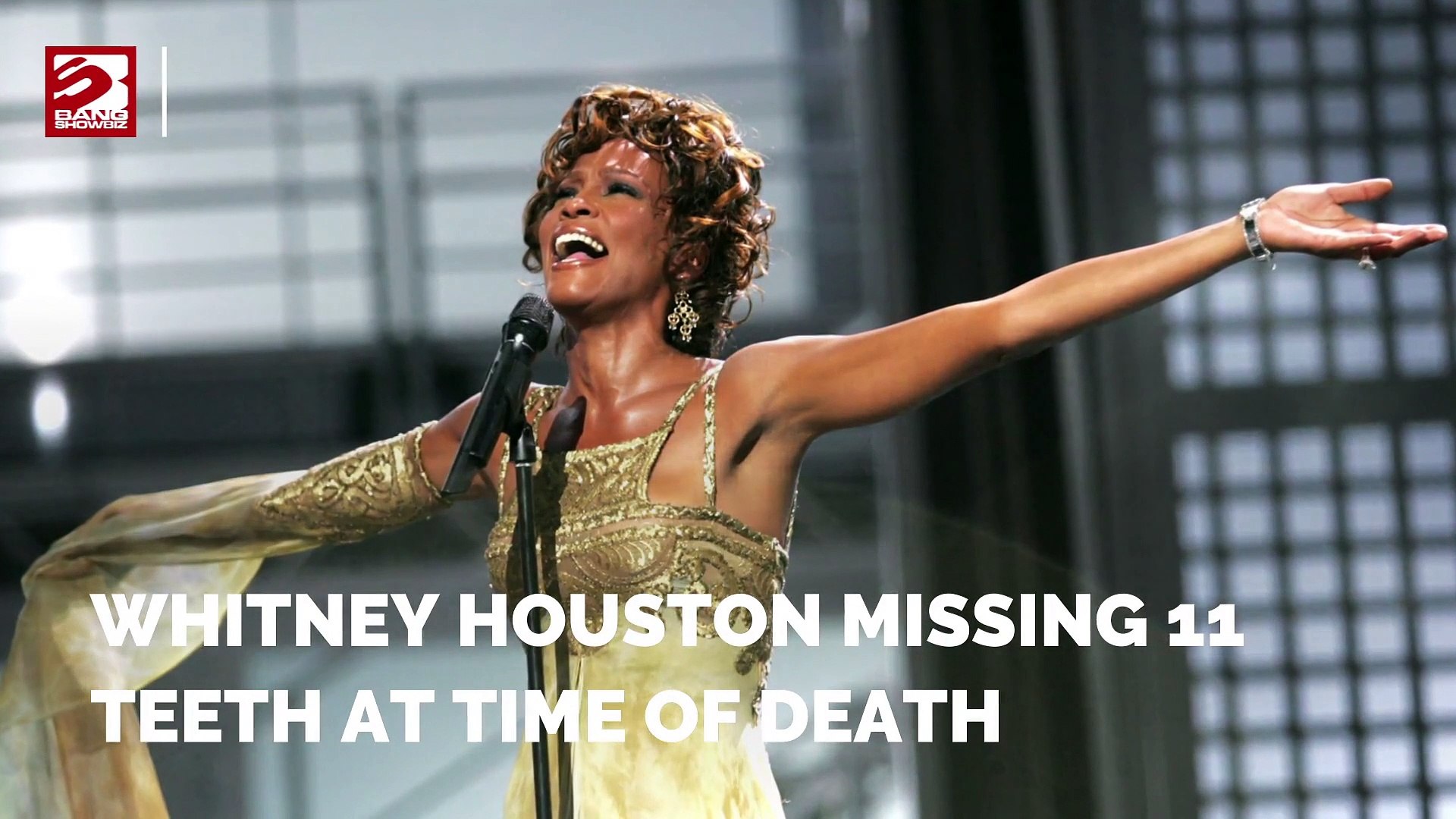 Whitney-Houston-missing-11-teeth-at-time-of-death