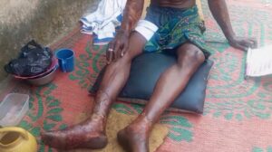 Survivors recount horror of Nigeria fuel truck explosion
