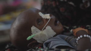 Nutrition for Growth Summit: leaders call for solidarity amid a funding crisis