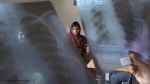 Tuberculosis: An ancient killer we can’t seem to defeat