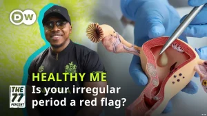 Are you struggling with acne, weight gain and weird periods?