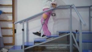 Meet the Syrian children gaining hope with artificial limbs