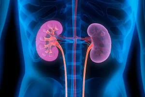 Kidney disease – causes, symptoms and how to treat it