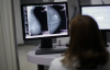 How AI is expanding breast cancer screening in Mexico