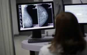 How AI is expanding breast cancer screening in Mexico