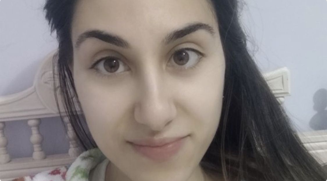 AUGC se une a la petición de ayuda de Miriam, hija de un guardia civil con síndrome de Wilkie