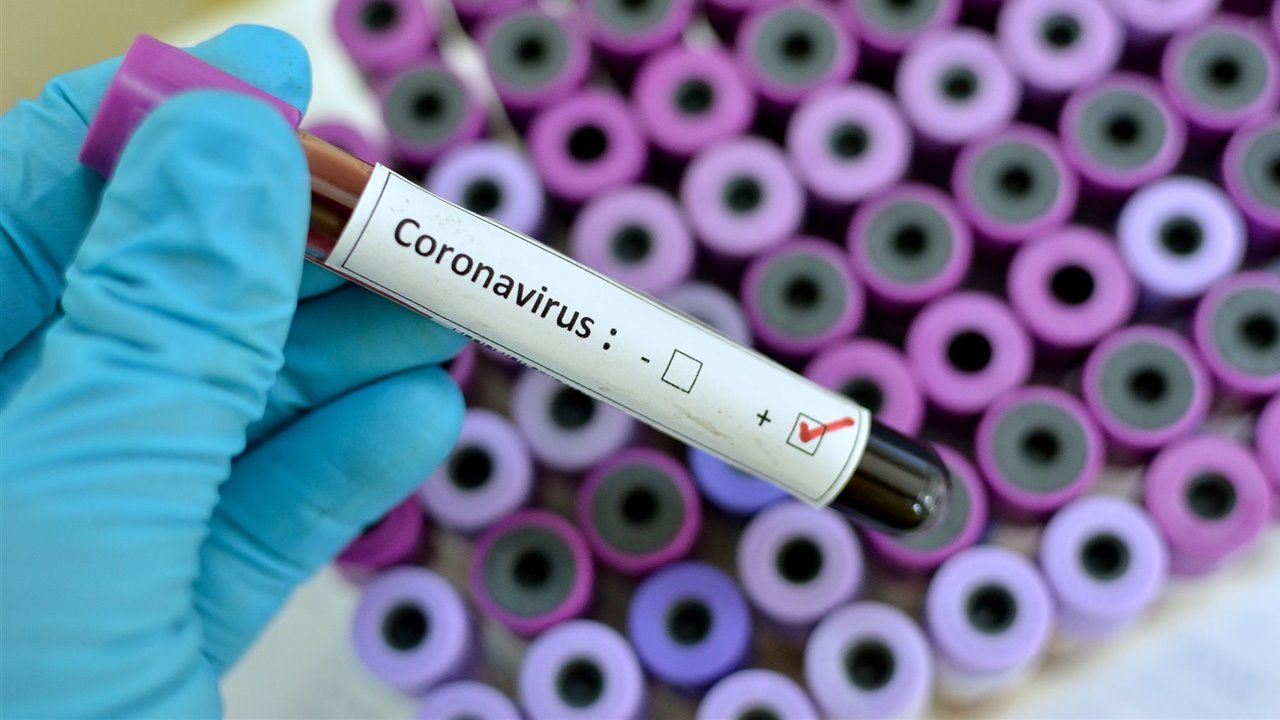 AUGC solicita medios e instrucciones precisas para hacer frente a la amenaza del virus COVID-19