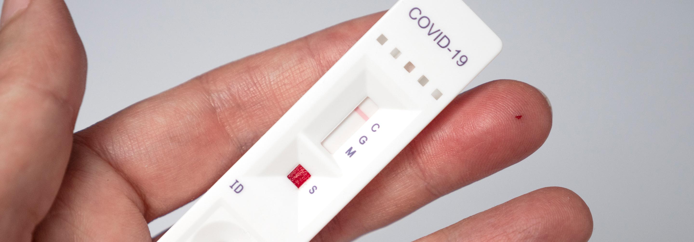 Los hijos de los guardias civiles no pueden acceder a los test de antígenos gratuitos que se están haciendo a los escolares gallegos