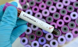 AUGC solicita medios e instrucciones precisas para hacer frente a la amenaza del virus COVID-19