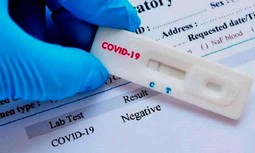 Descuentos para afiliados de AUGC y familiares en las pruebas de detección del COVID-19