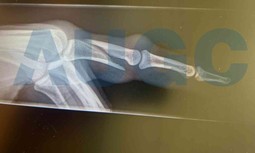 Nueva agresión a un guardia civil en el Aeropuerto de Lanzarote